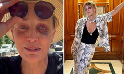 SHARON STONE'UN BAŞINA GELEN TALİHSİZ KAZA ŞAŞKINLIK YARATTI! KAZA DEĞİL, DAYAK YEMİŞ GİBİ GÖRÜNÜYOR