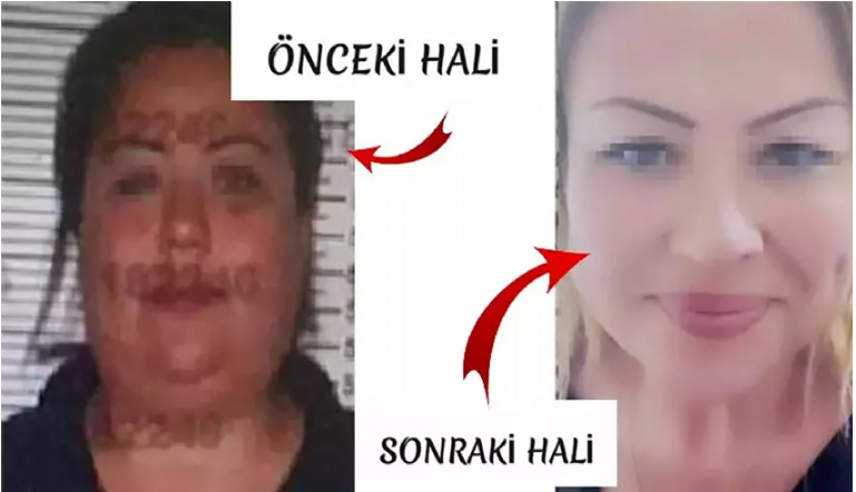 ÇEK DOLANDIRICISI YAKALANMAMAK İÇİN ESTETİKLE KARDEŞİNİN YERİNE GEÇTİ