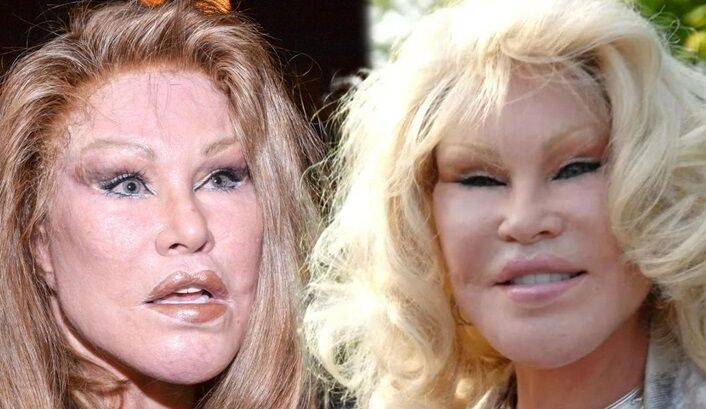'Kedi Kadın' olarak biliniyordu: Wildenstein, hayatını kaybetti